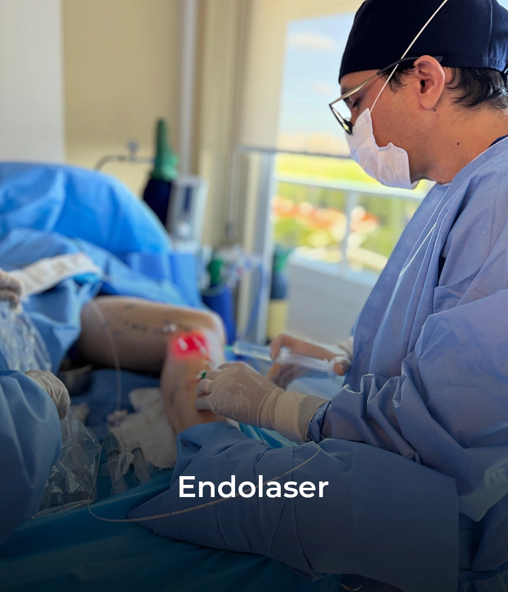 Endolaser