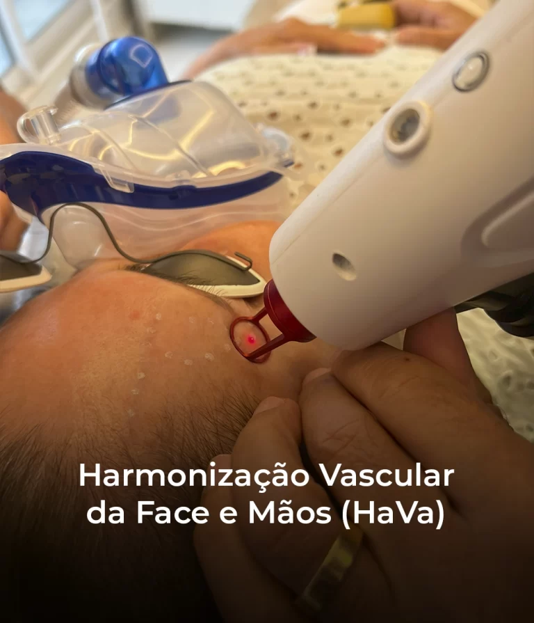 Harmonização Vascular da Face e Mãos (HaVa)