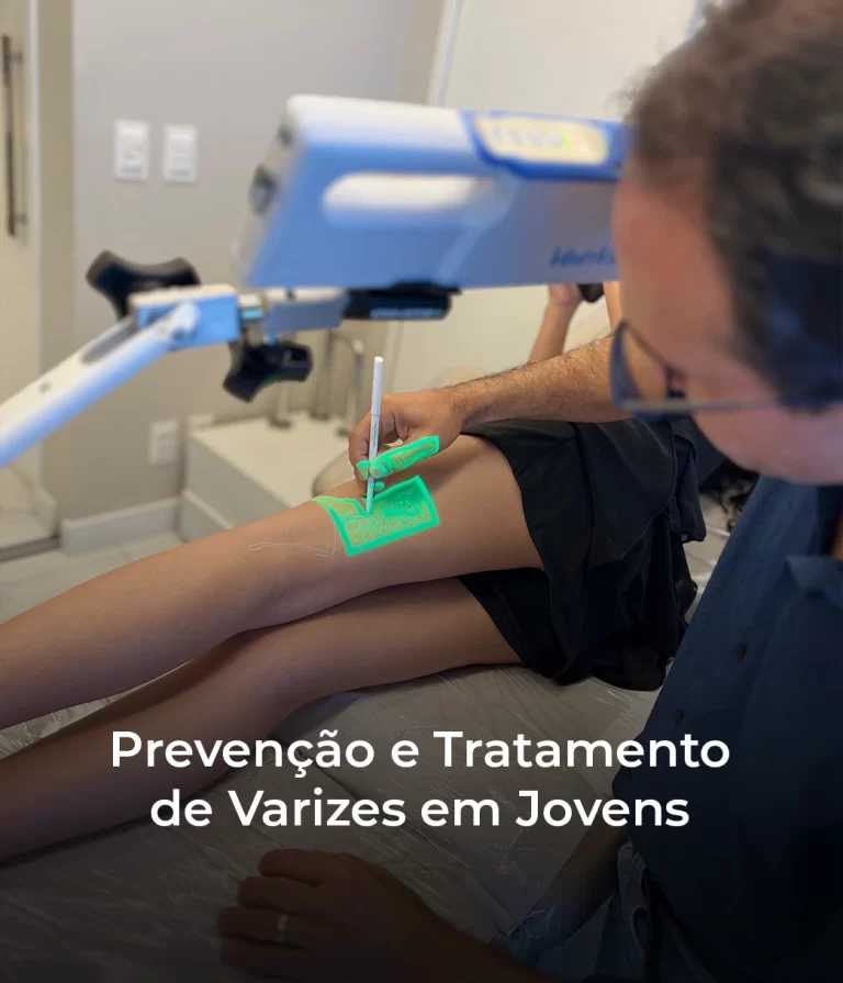 Prevenção e Tratamento de Varizes em Jovens