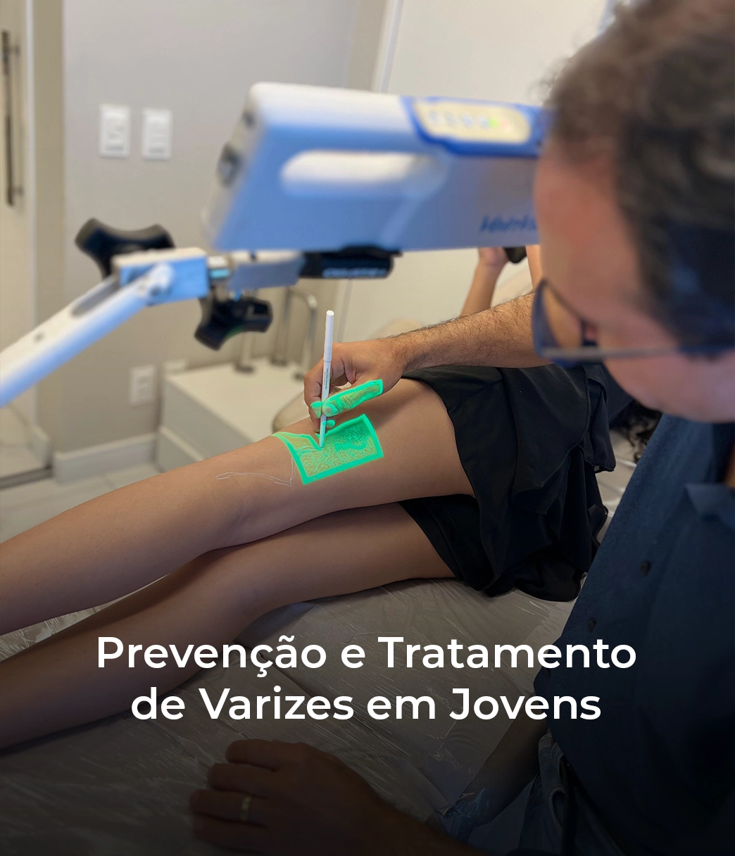 Prevenção e Tratamento de Varizes em Jovens