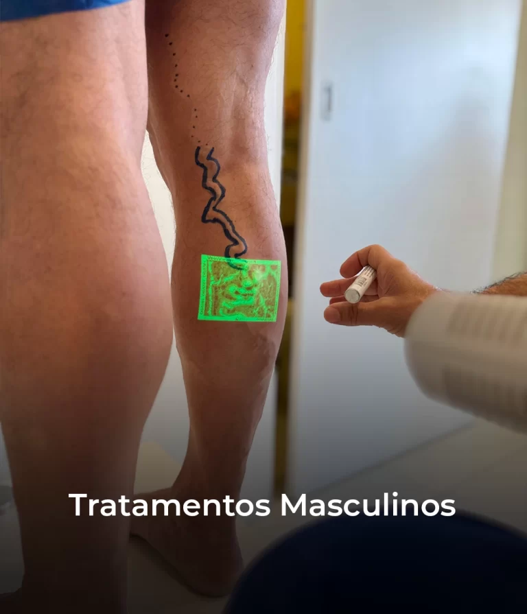 Tratamentos Masculinos